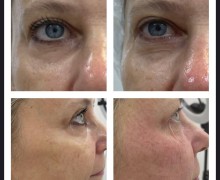 Beauty skin